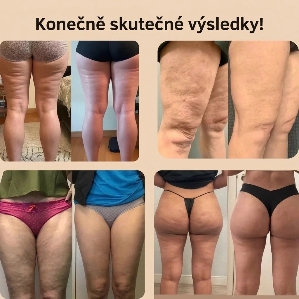 3D anti-celulitidní šortky